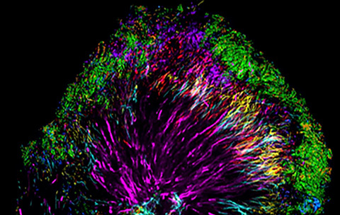 Far from a random grouping of cells, the microbiome community in human dental plaque is well-organized. 