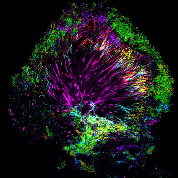 Far from a random grouping of cells, the microbiome community in human dental plaque is well-organized.