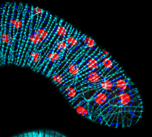 fruit fly glands