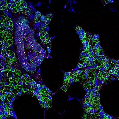 RNA for SARS-CoV-2 (pink) and the ACE2 receptor (white) was found in human salivary gland cells, which are outlined in green.