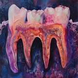 Watercolor painting esque image of the molars and roots with the purple gums/backdrop