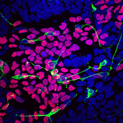 Markers of normal development of the brain, spinal cord and craniofacial skeleton (pink, green, yellow.