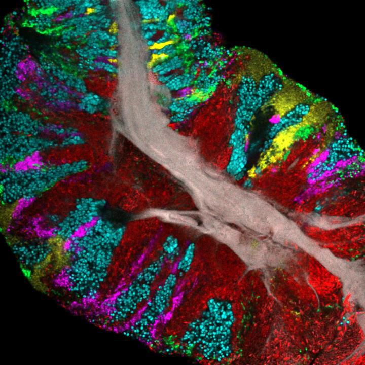 Bacterial biofilm scraped from the surface of the tongue and imaged. Human epithelial tissue forms a central core (gray). Colors indicate different bacteria. | Steven Wilbert and Gary Borisy